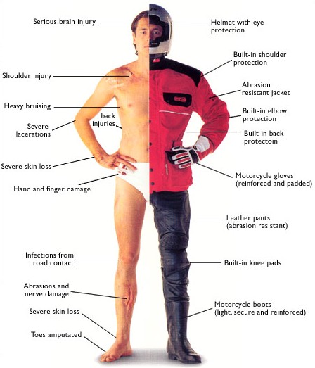 motorcycle-injuries